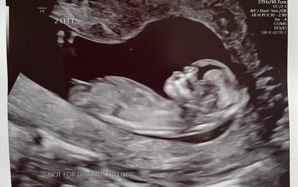 October - into the second trimester!