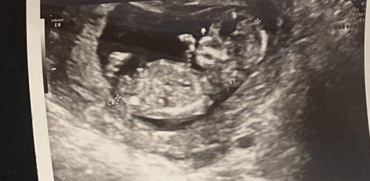 Has anyone been told the gender at 12 week scan?