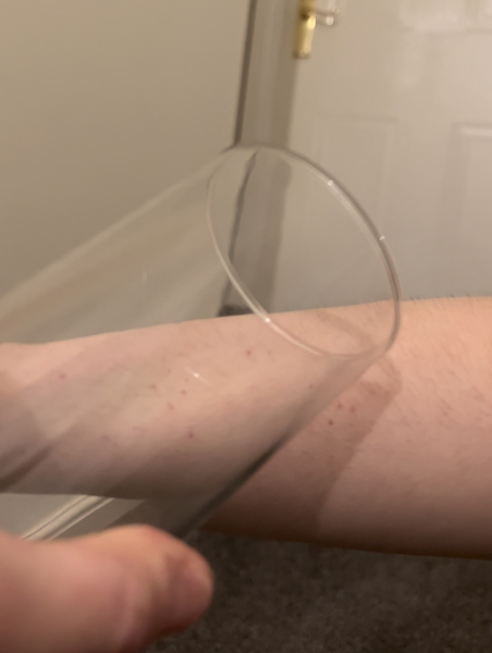Help! What is this rash? *pictures attached*