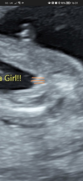 Did they tell us the wrong gender?