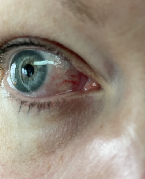 How can I make my eye look better?
