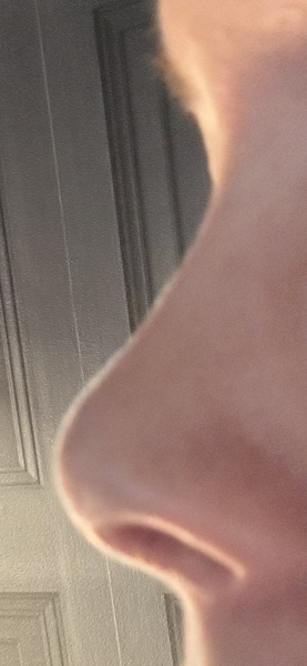 To be in tears over my nose?