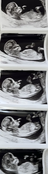 October - into the second trimester!