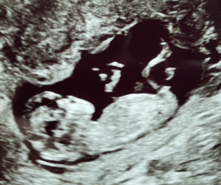 October - into the second trimester!