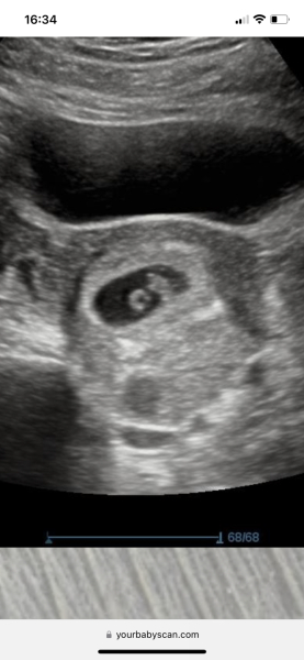 Due November 2023 - part 2