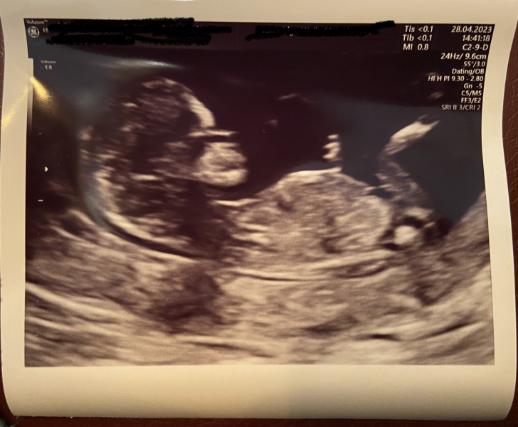 ERA/Alice/Emma infertility thread graduates/pregnancies