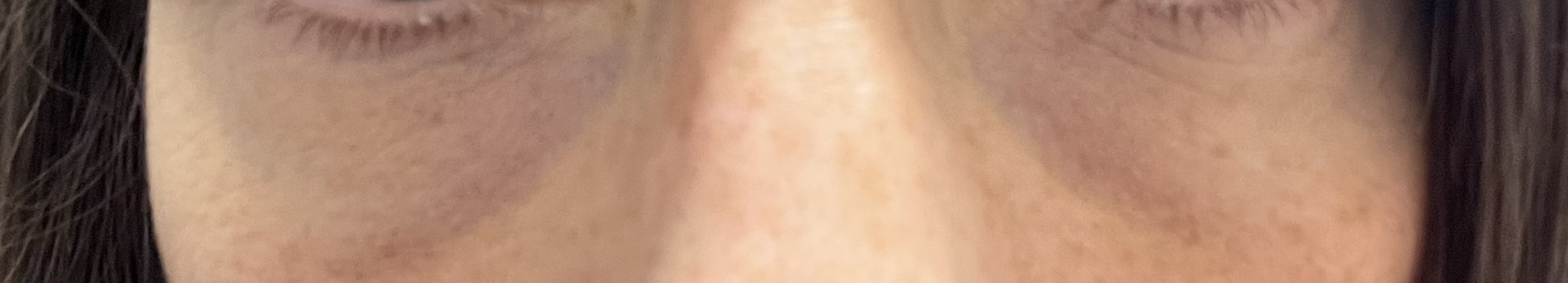Glasses to cover dark circles 