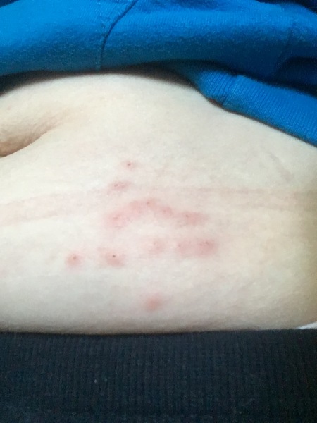 Are these bites?