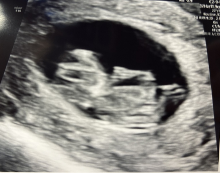 October - into the second trimester!