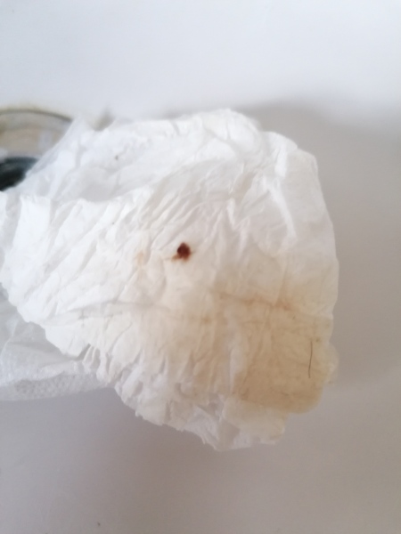 Implantation bleeding? 