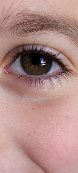 Eye colour
