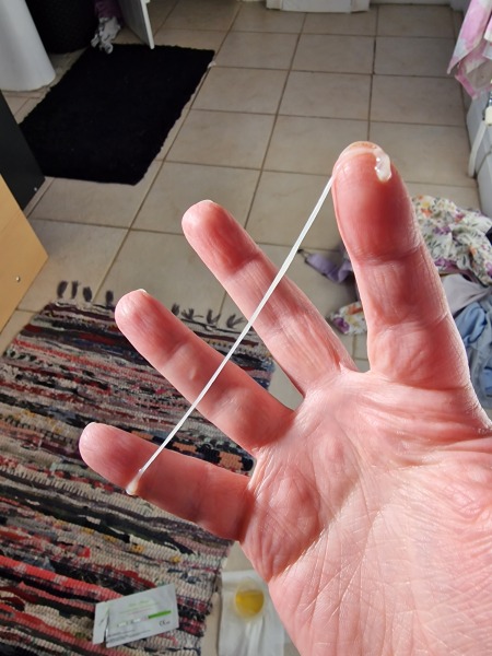 Ewcm or sperm? *pics*