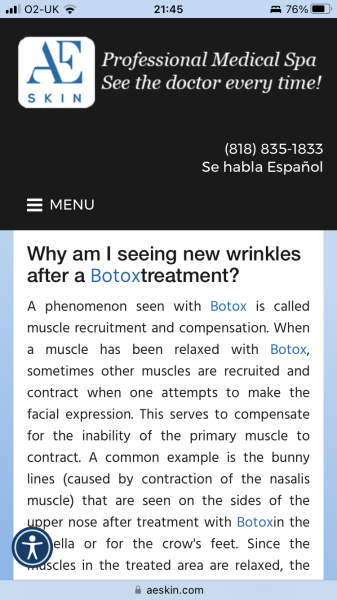 Botox question