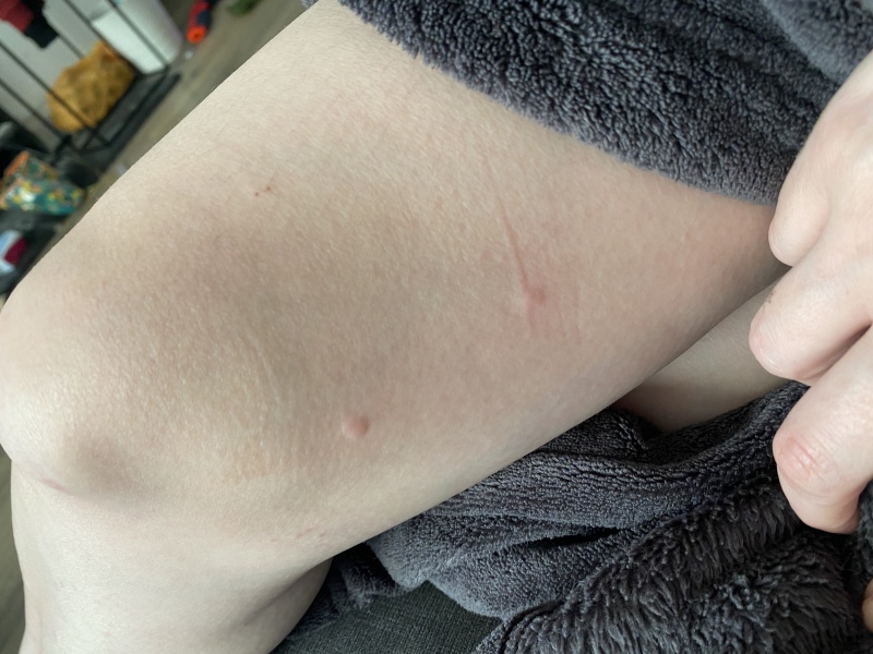 Do I need a second opinion on this? Medication related