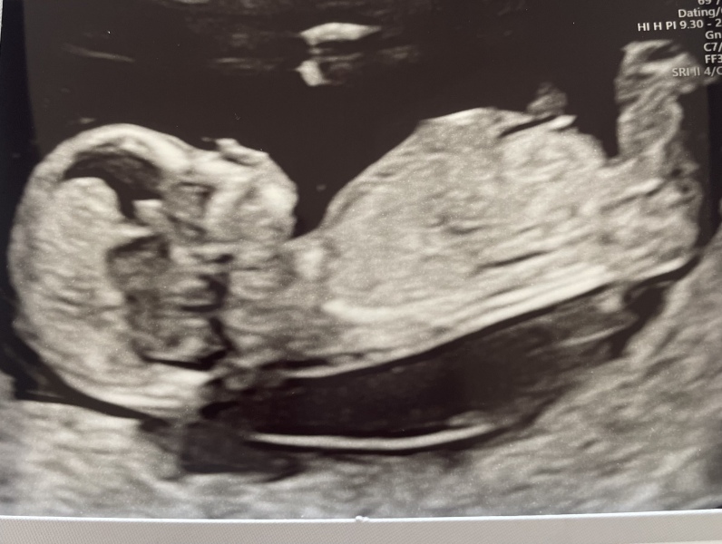 October - into the second trimester!