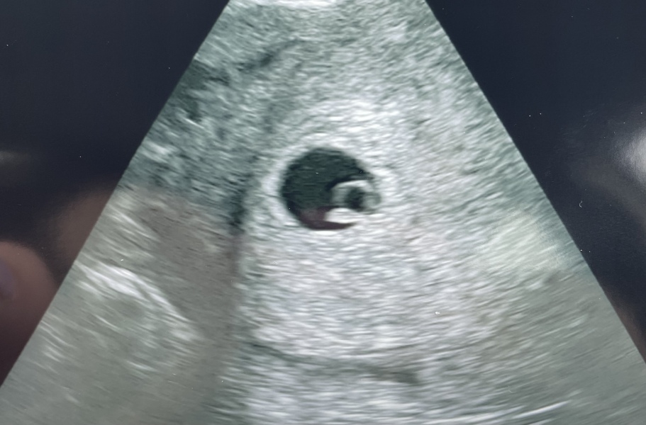 6dpo positive pregnancy test 