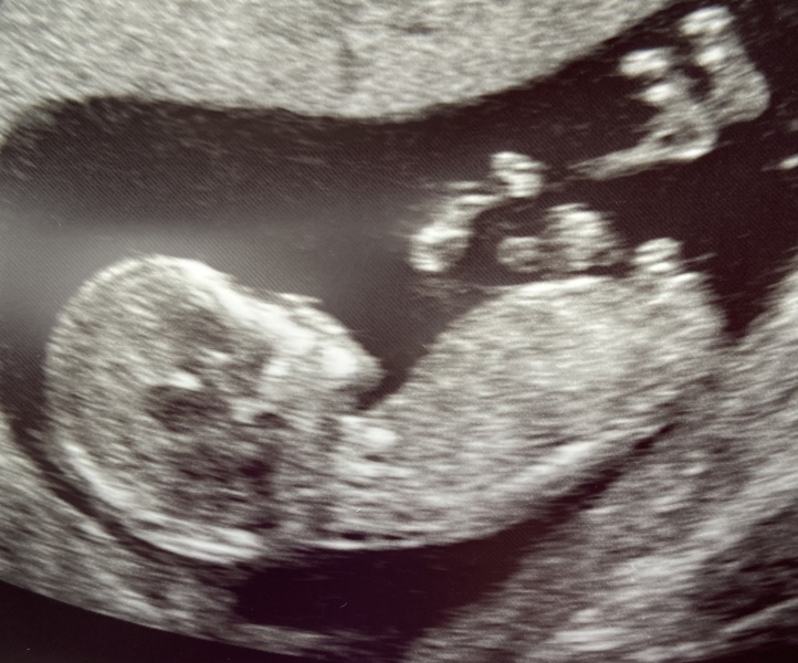 October - into the second trimester!