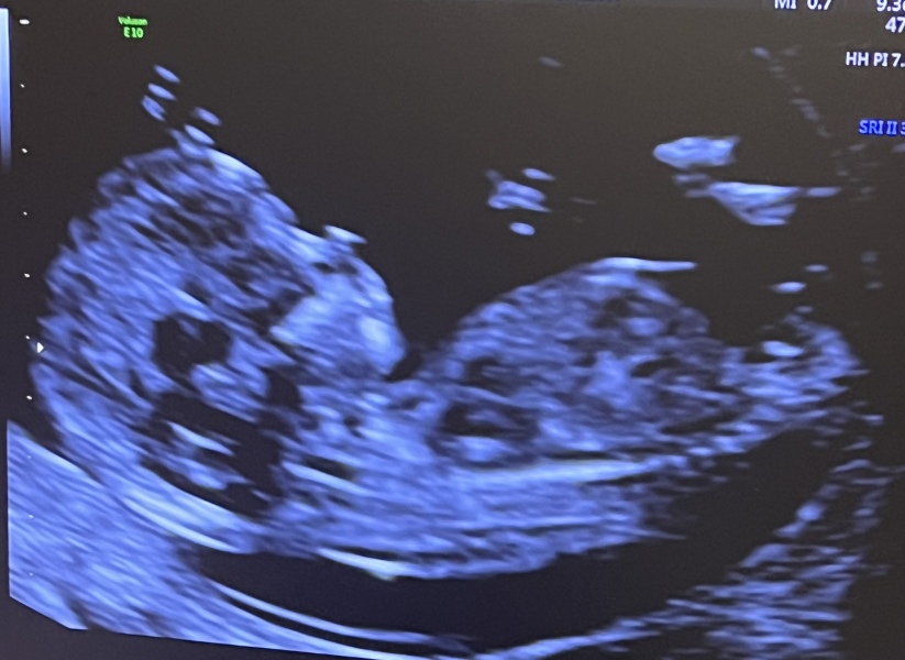 October - into the second trimester!