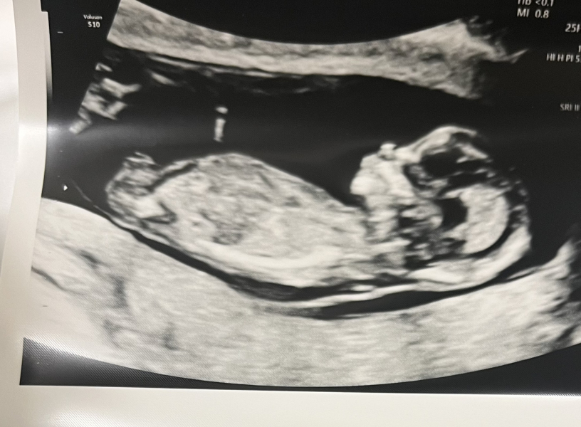 October - into the second trimester!