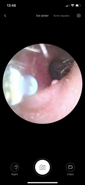 What is this in my ear??