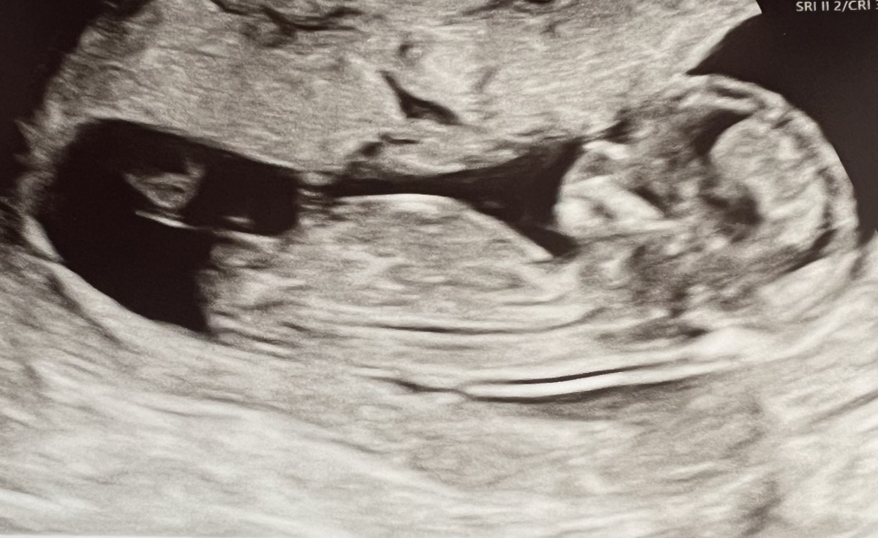 October - into the second trimester!
