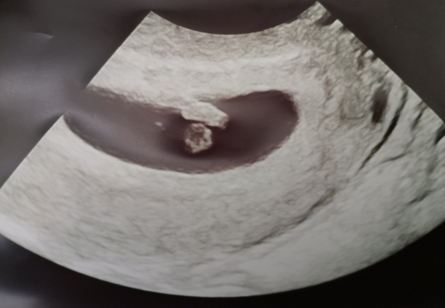 Due December 2023