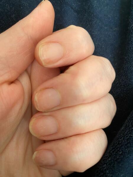 My nails are crap