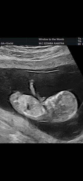 For fun - any theories on girl / boy?