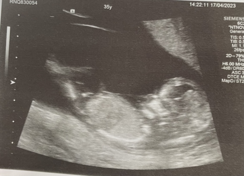 October - into the second trimester!