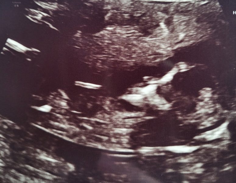 Any guesses on gender?