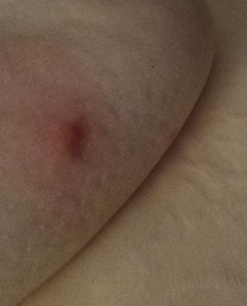 Scared about cancer