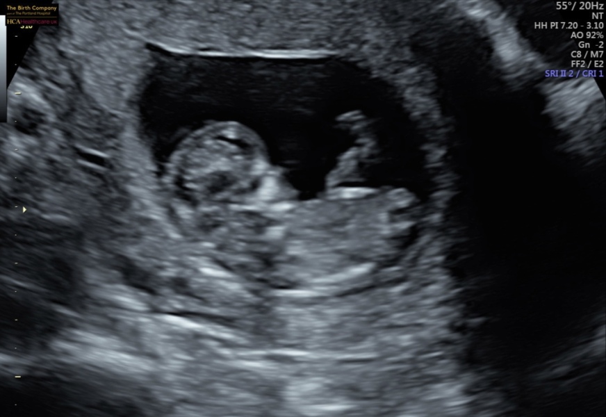 October - into the second trimester!