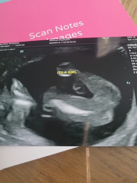 Did they tell us the wrong gender?