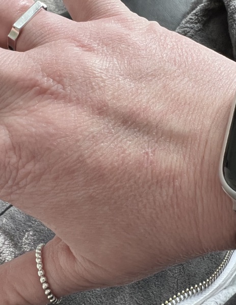 Help my hands