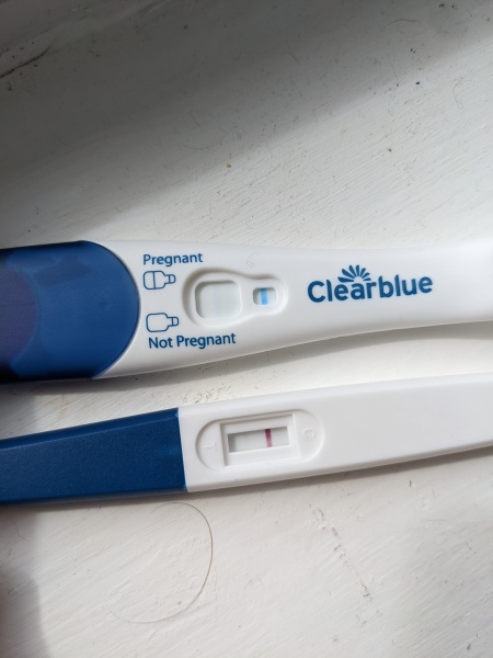 Conceiving after ectopic