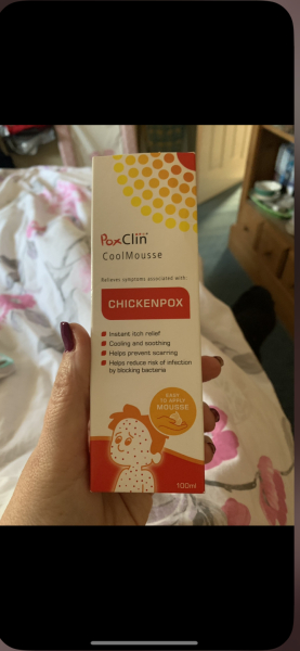 To think chickenpox is not guaranteed 