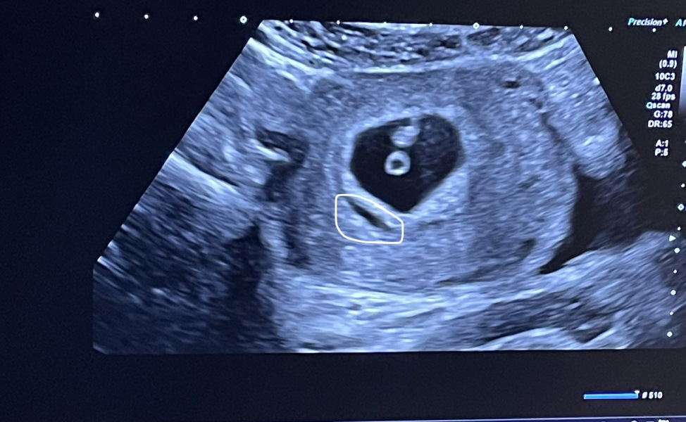 Due November 2023 - part 2