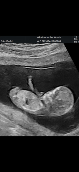 October - into the second trimester!