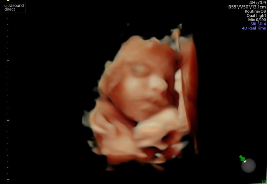 July 2023 (Thread 2)! 