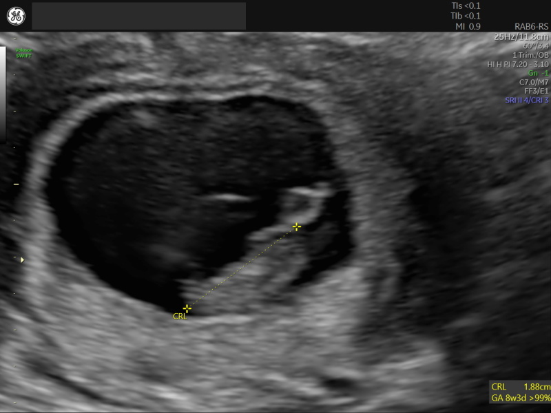 TWW - Testing Around 1st March 