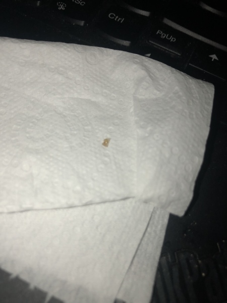 Yellow crust in one nipple (pic attached)