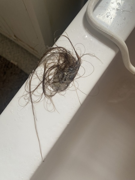 Low iron and severe hair loss? Help!