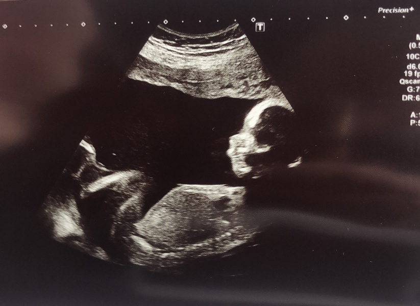 August Due Date Crew (Thread 8)
