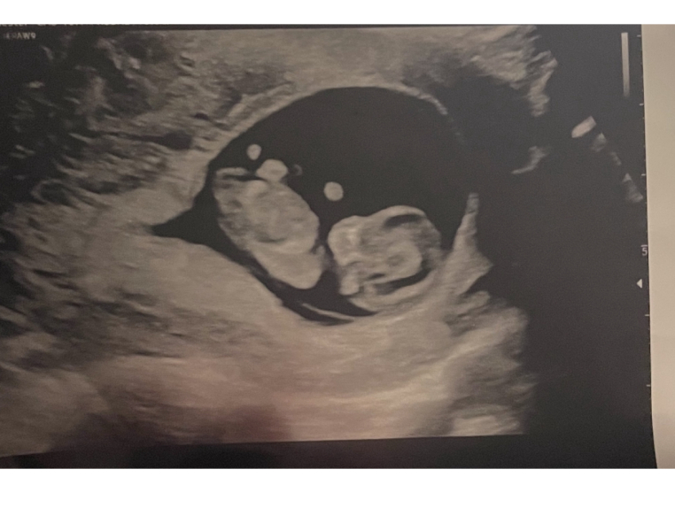 Due November 2023 - part 2