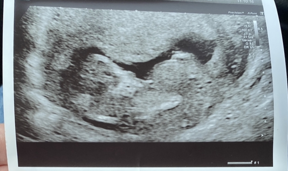 October - into the second trimester!