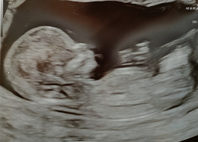 Due October 2023 - thread 6