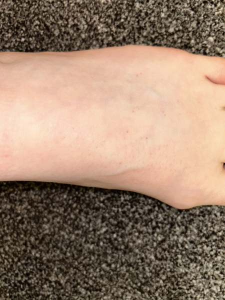 Help! What is this rash? *pictures attached*