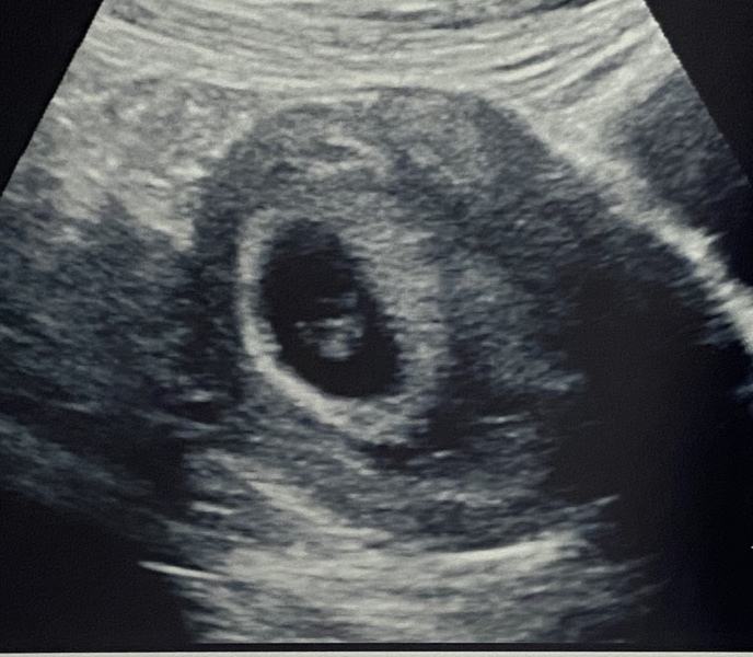 Due November 2023 - part 2