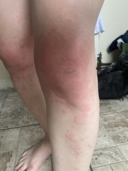 Do I need a second opinion on this? Medication related