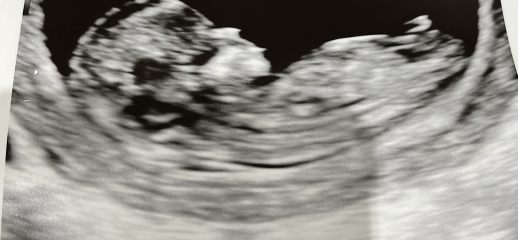 Due November 2023 Part 3